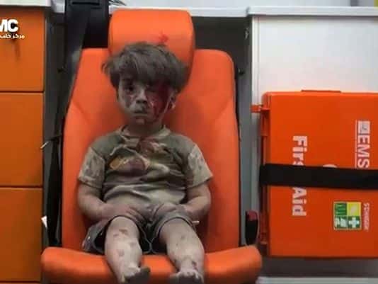 The Aleppo Poster Child