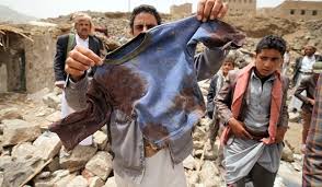 Acceptable Losses:  Aiding and Abetting the Saudi Slaughter in Yemen